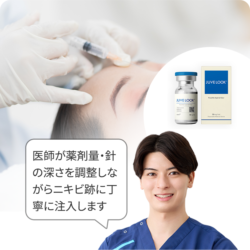 手打ち水光(ジュベルック)+トラネキサム酸