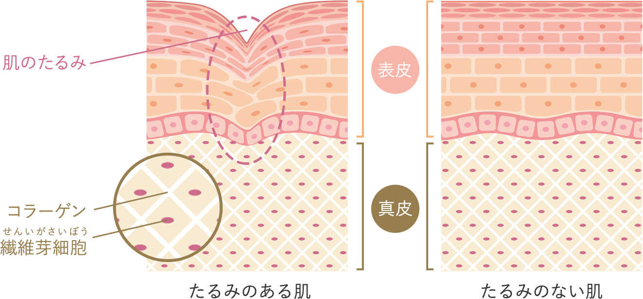 美肌ショッピングリフト イメージ