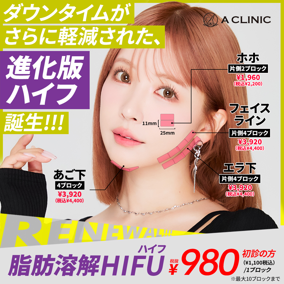 HIFU