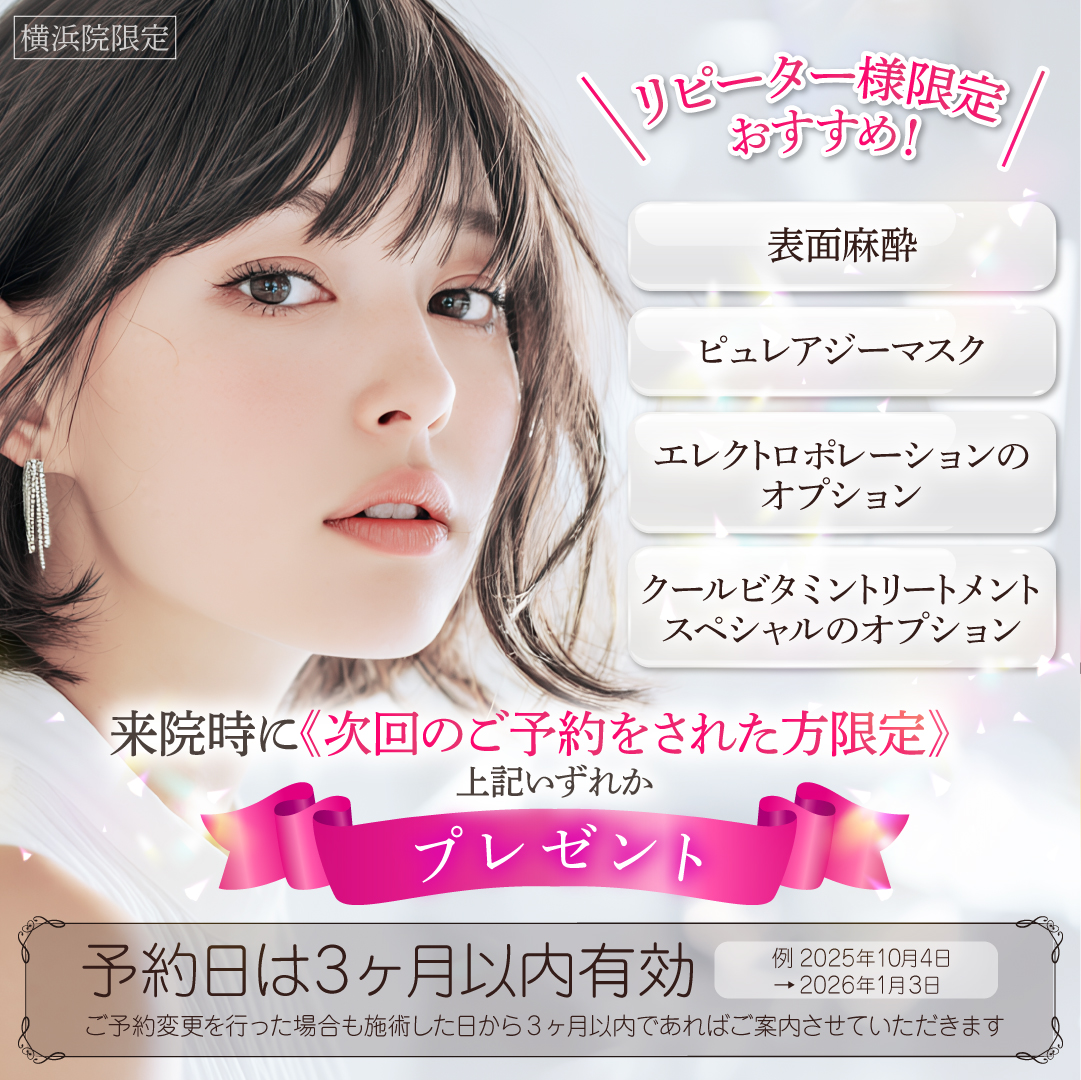 リピーター限定キャンペーン