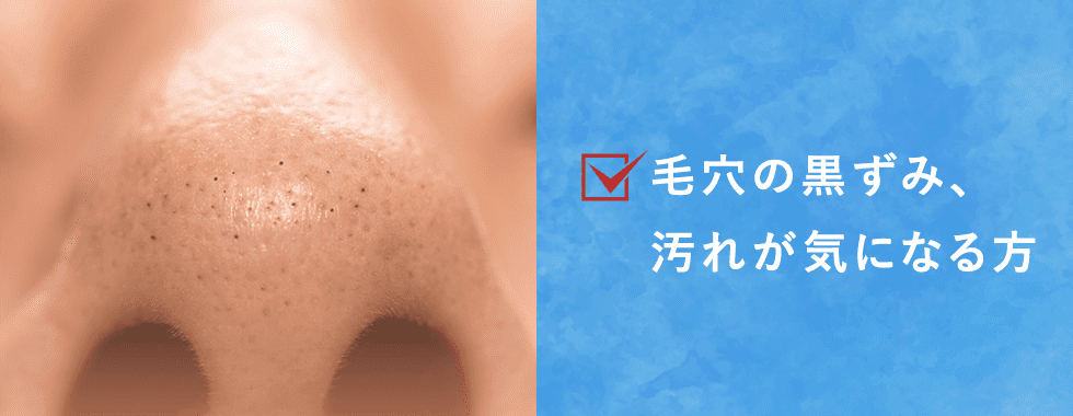 毛穴の黒ずみ、汚れが気になる方