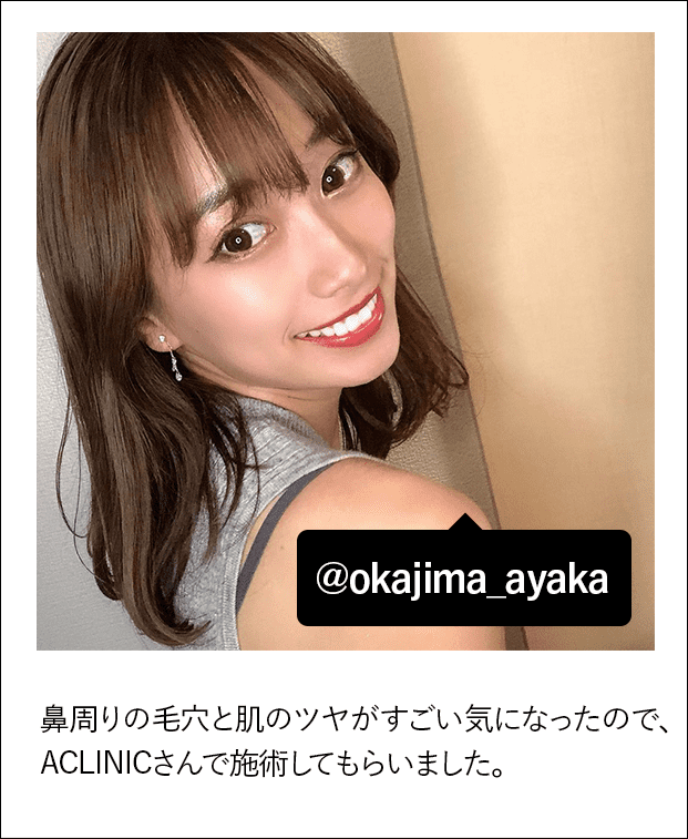 鼻周りの毛穴と肌のツヤがすごい気になったので、ACLINICさんで施術してもらいました。