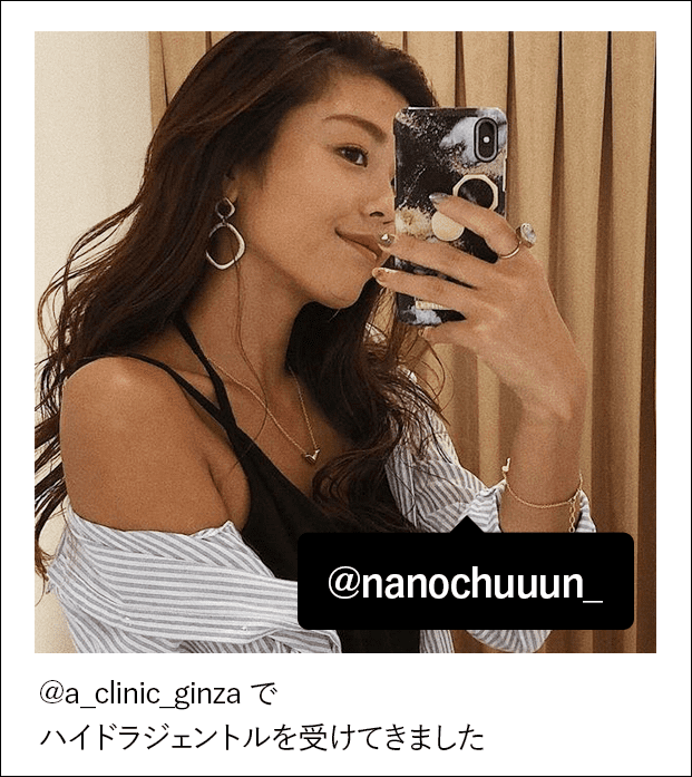 @a_clinic_ginza でハイドラジェントルを受けてきました