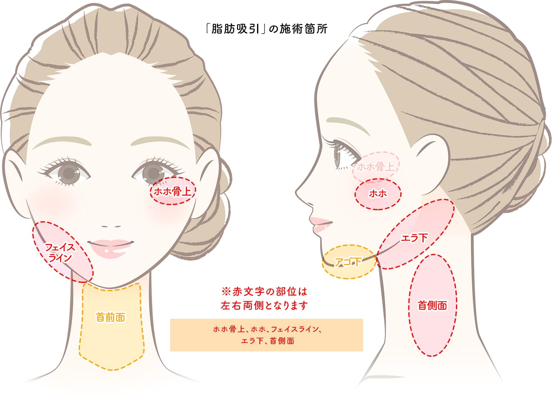 1day小顔®おためしモニター