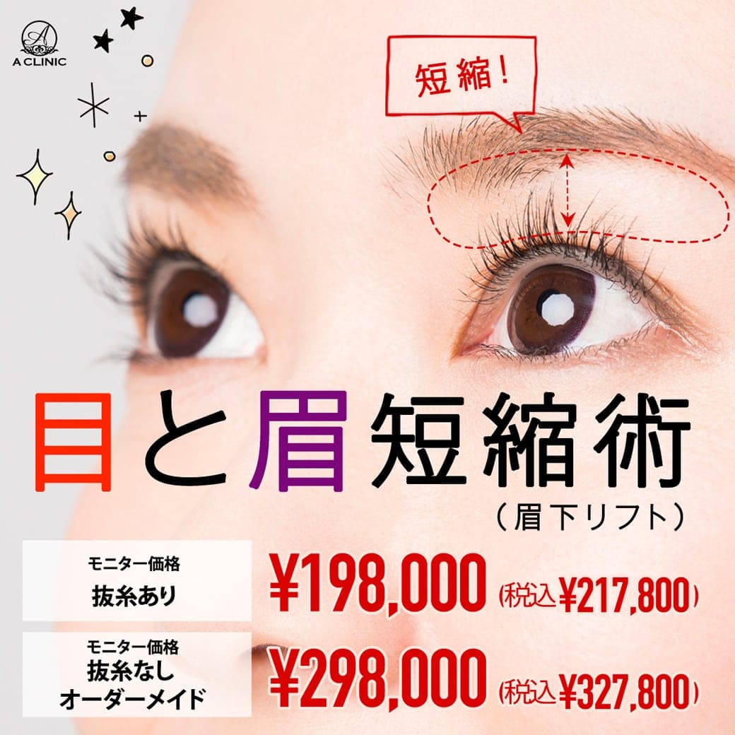 目と眉短縮術（眉下リフト）