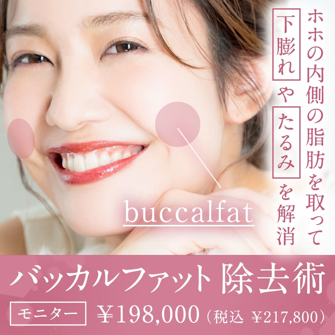 バッカルファット除去術