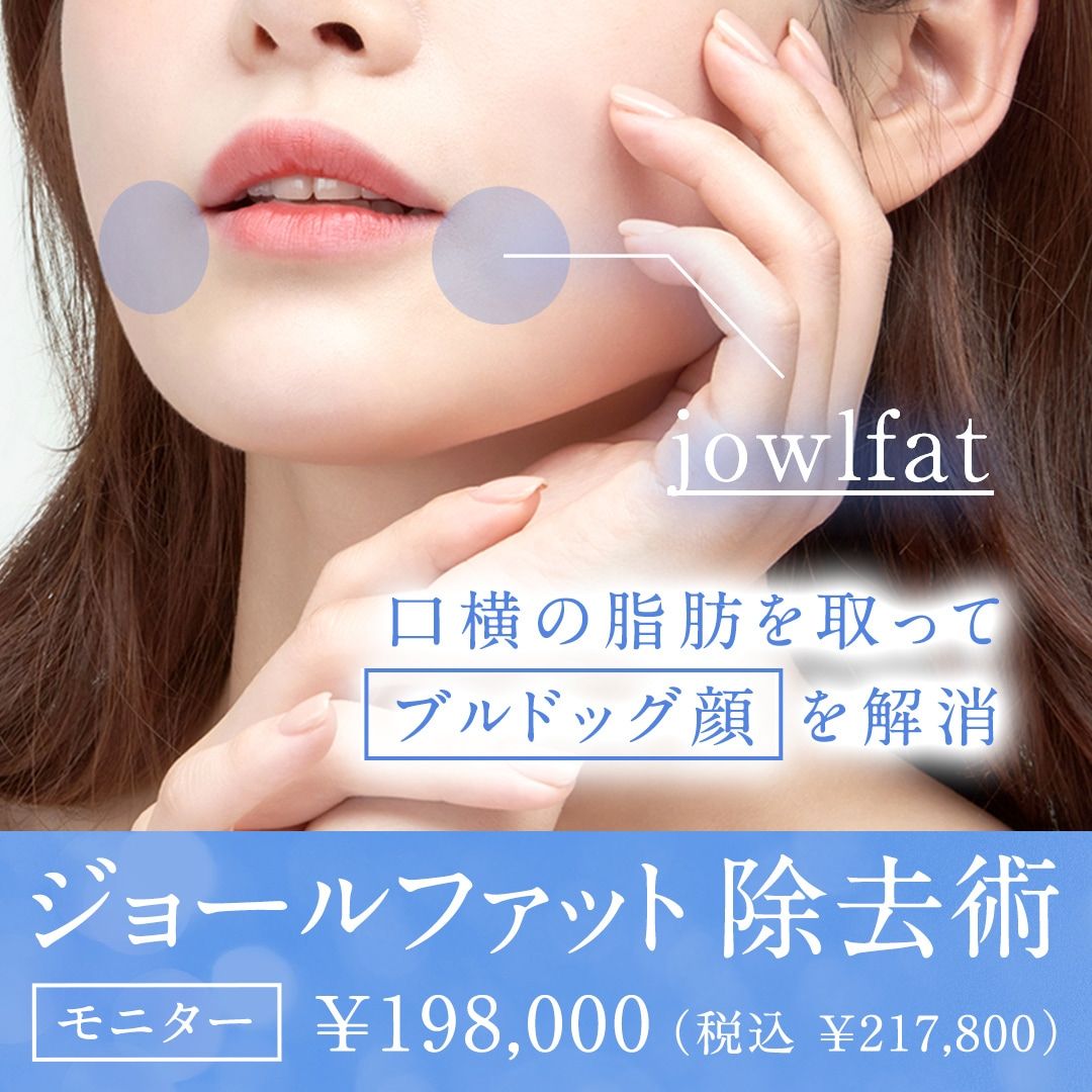 ジョールファット除去術
