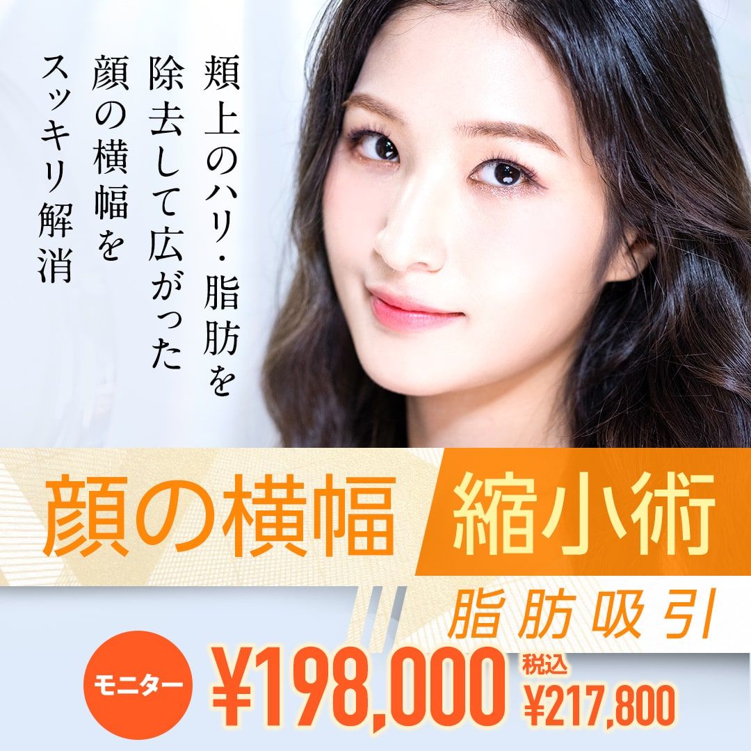 顔の横幅縮小術（脂肪吸引）モニター