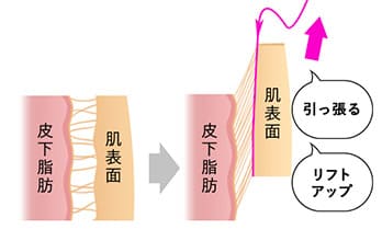 理想的な輪郭を叶える