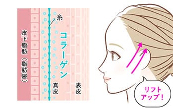 コラーゲンの生成促進