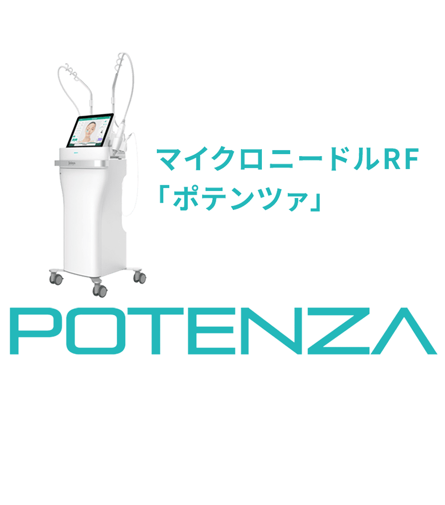 ポテンツァ（potenza）