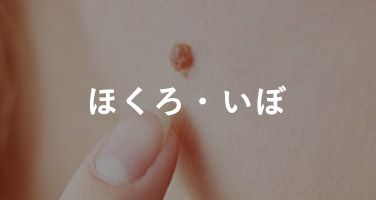 ほくろ・いぼ