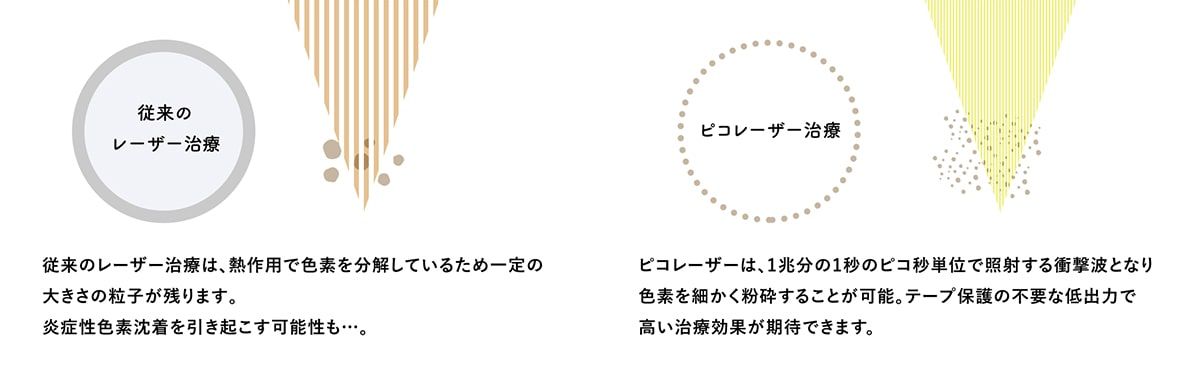 ピコトーニングの治療効果