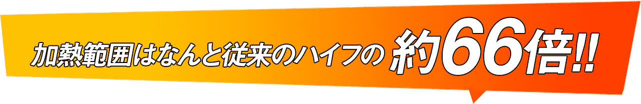 従来のHIFU 一列で直線のみ照射