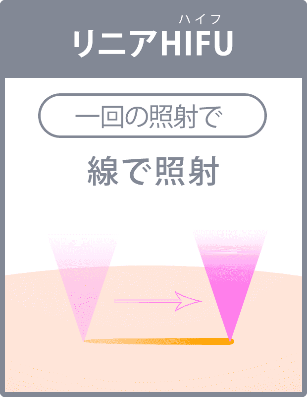 脂肪溶解HIFU 多列で面上の照射