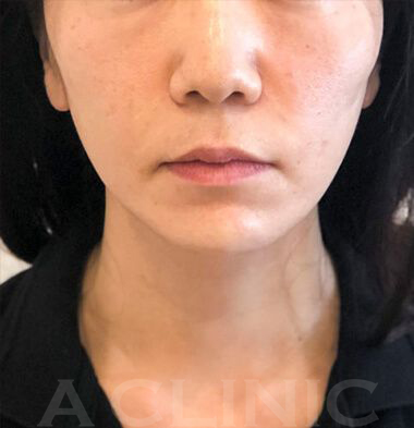 患者様写真4