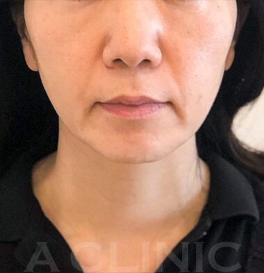 患者様写真