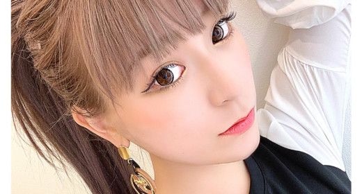 Aスレッド®︎（糸リフト）